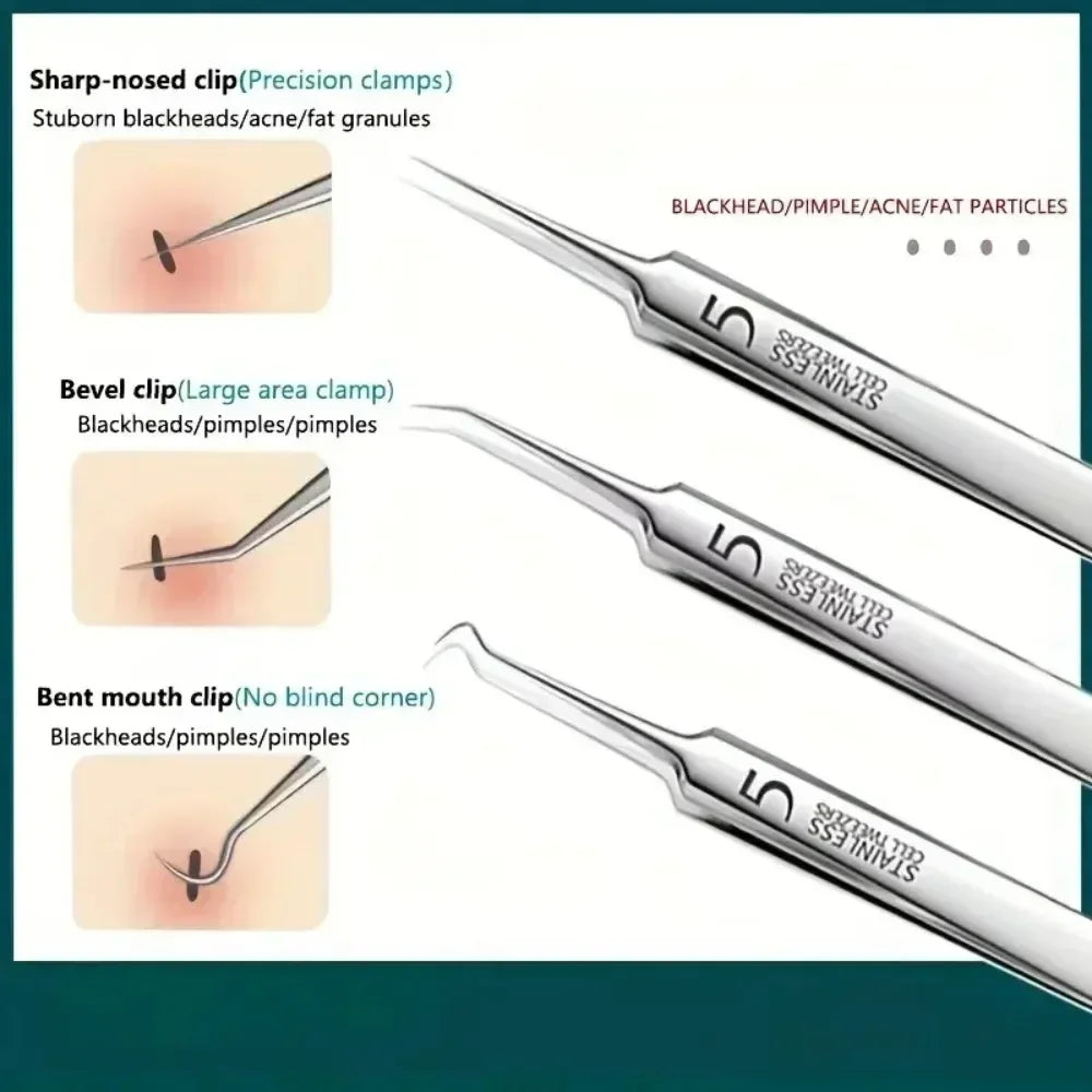 1/3/8PCS Stainless Steel Acne Clip Cell Clip Blackhead Clips Acne Remover Acne Needle Pore Cleaner Beauty Salon Skin Care Tools