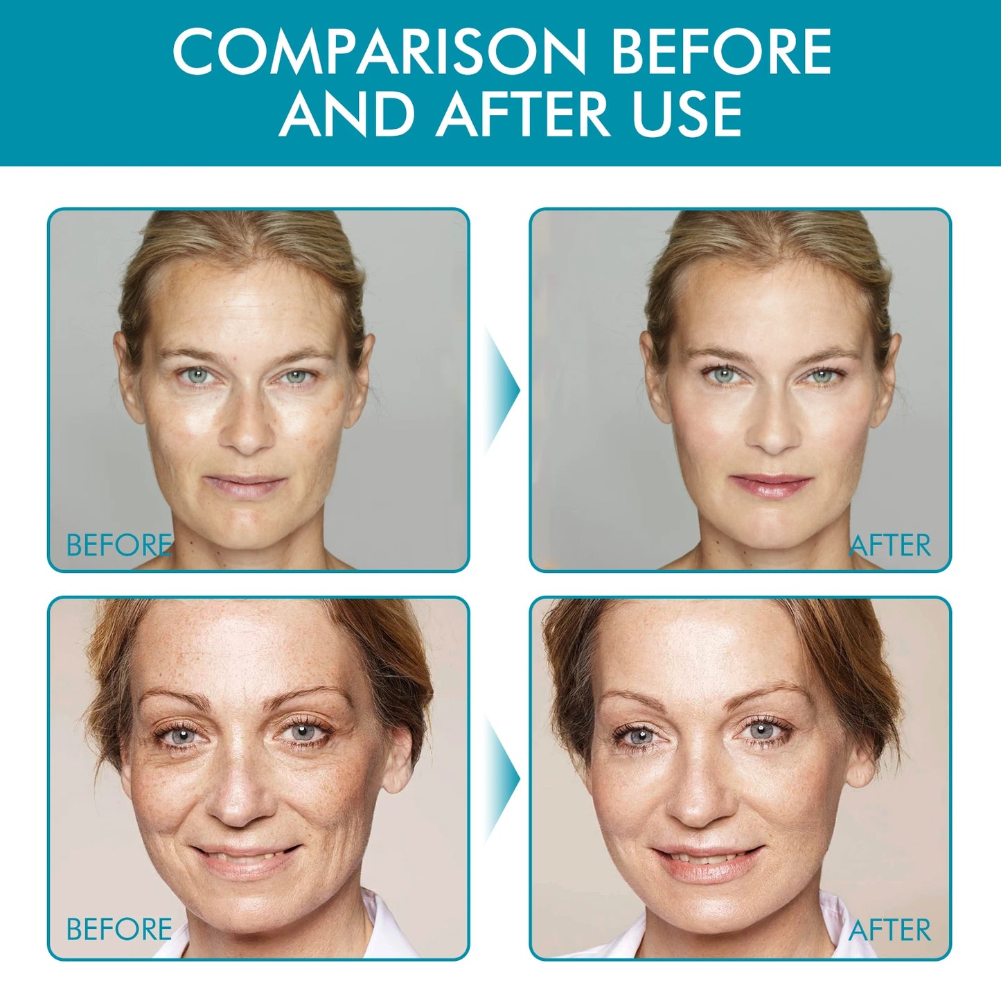 Anti Aging Retinol Collagen Day Night Moisturizer Face Cream Moist Hydrating Brightening Elastic Firming Smoothing Facial Cream