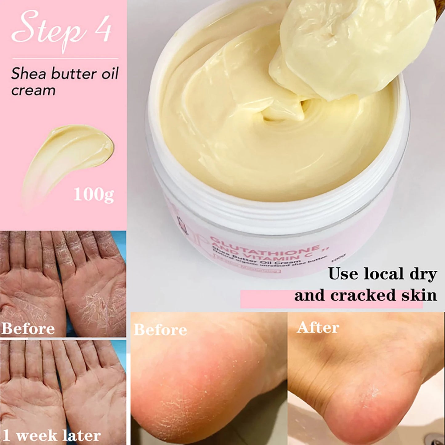 AILKE Whitening Moisturizing Anti-Freckle Body Lotion, Suitable For Face And Body, Glutathione Korean Women's Skin Care Products