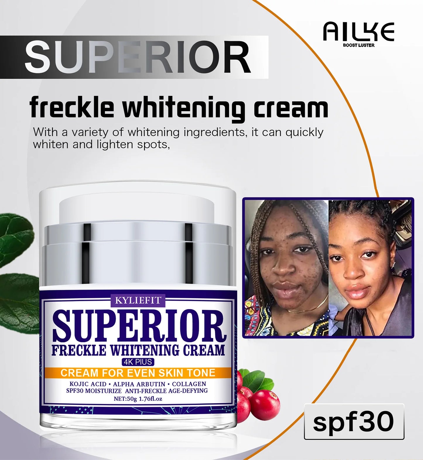 KYLIEFIT Dark Spot Remover for Face, Hyperpigmentation, Melasma, Freckle, Sun Spots Removal, Whitening Cream for Women and Men