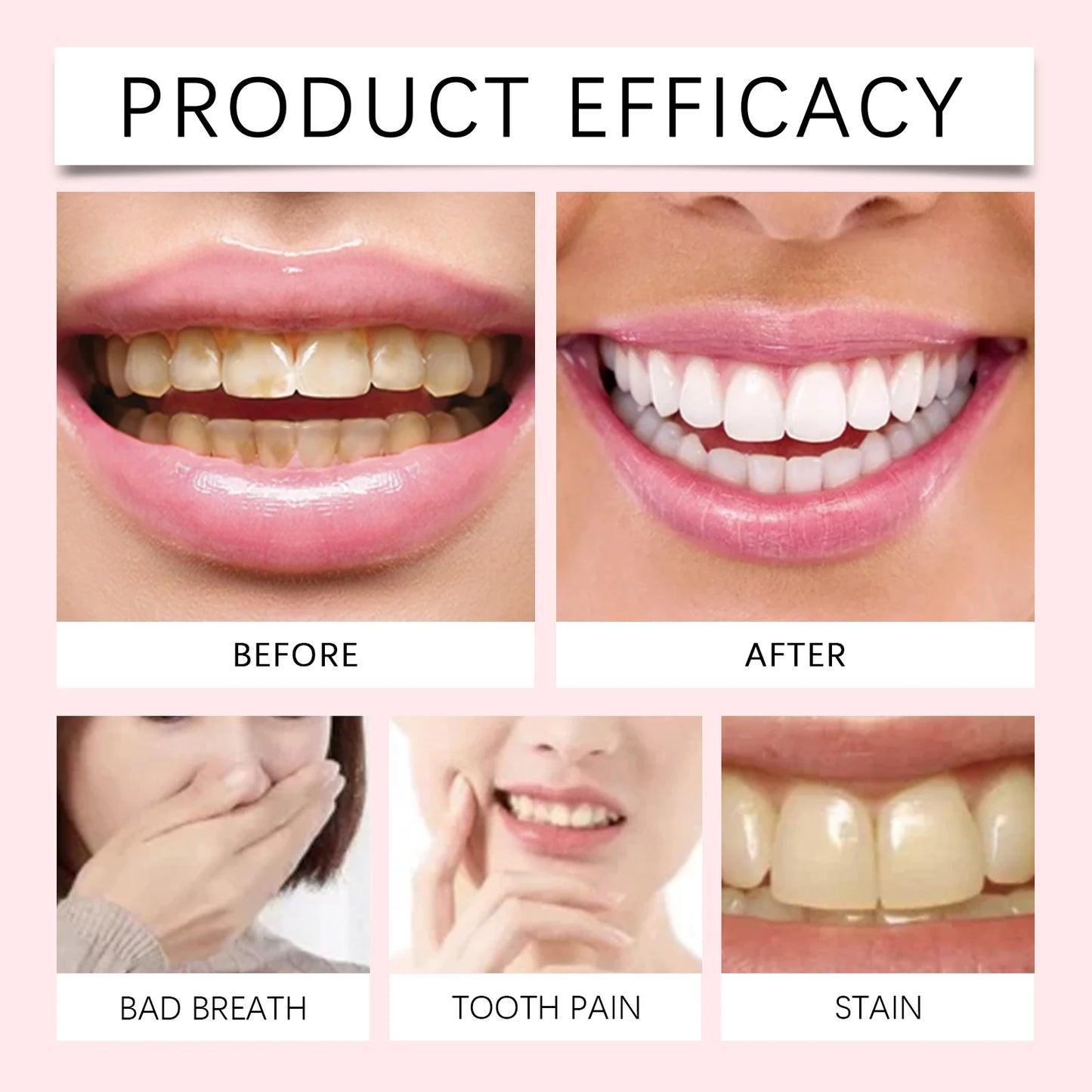 Oralhoe Niacinamide Toothpaste Remove Plaque Brightening Mint