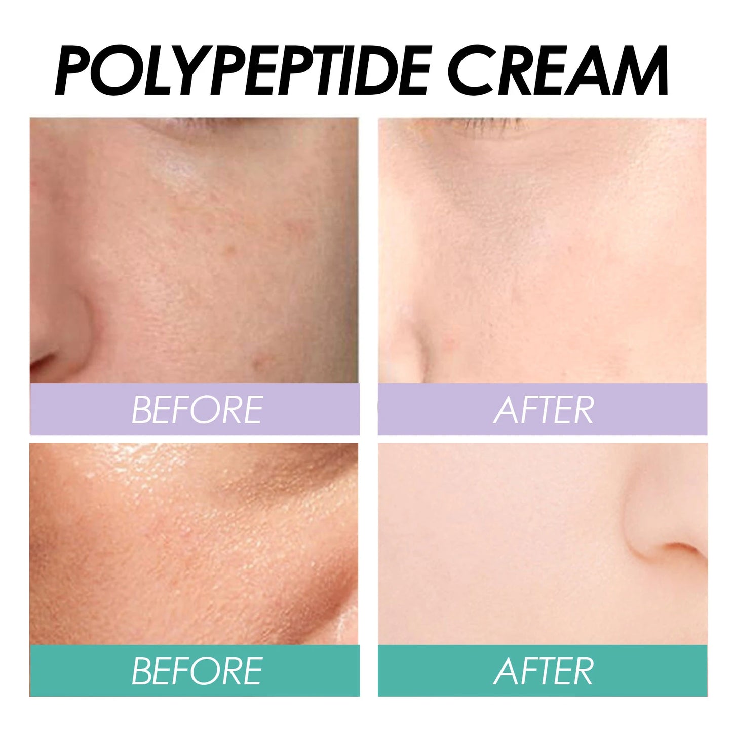 Hoygi Moisturizing Polypeptide Cream Skin Care Firming Wrinkle Removal Smooth Anti Aging Face Cream for Dry And Rough Skin