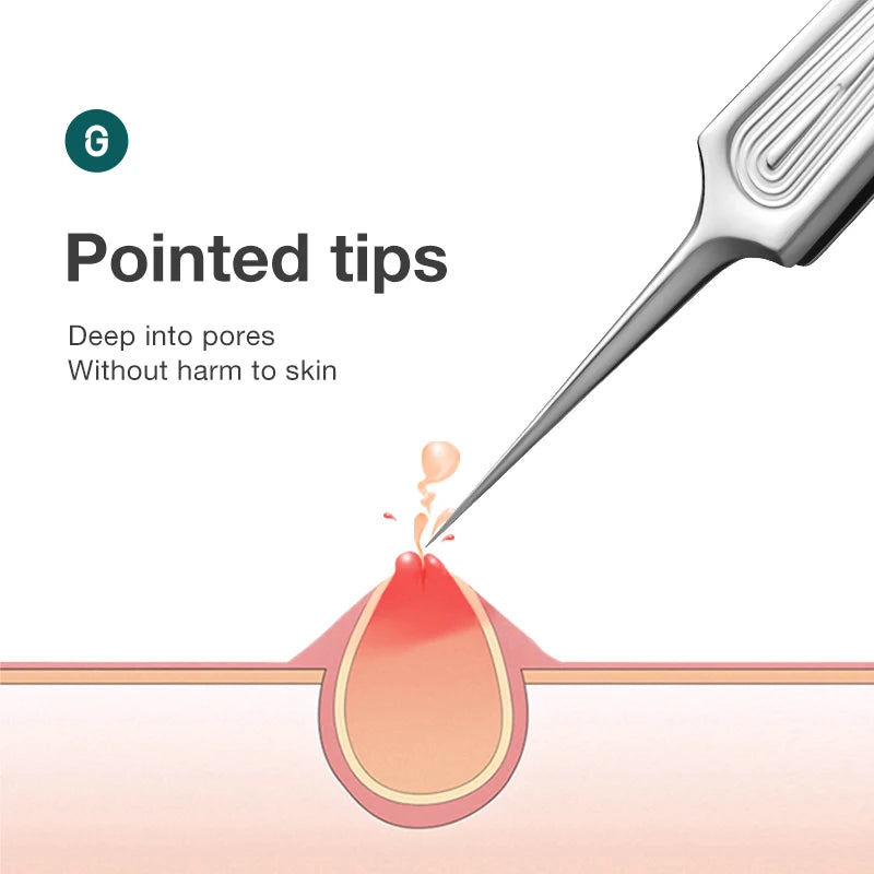 MR.GREEN Ingrown Hair Tweezers Needle Nose Pointed Tips