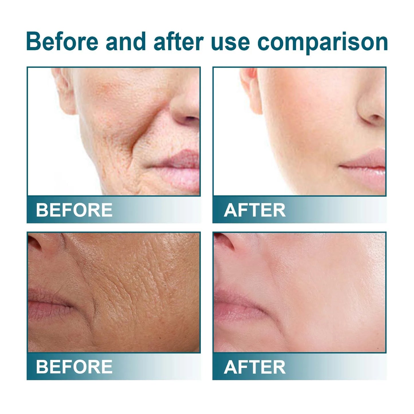 EELHOE Melanin Correcting Serum Fade Dark Spots Vitamin C