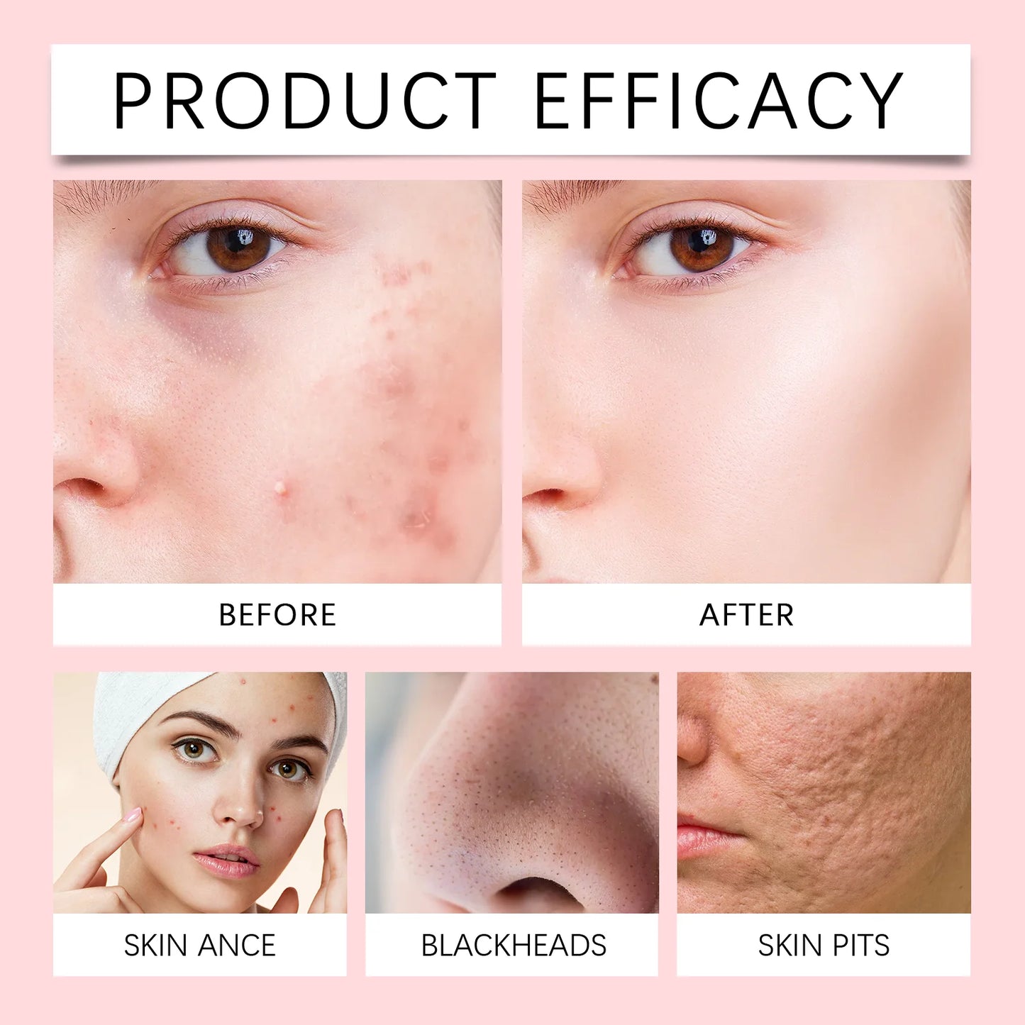 Revitalizing Korean Organic Salicylic Acid Foaming Face Cleanser - 4-in-1 Hydrating Cleansing Mousse, Soothing Skin, Oil Control
