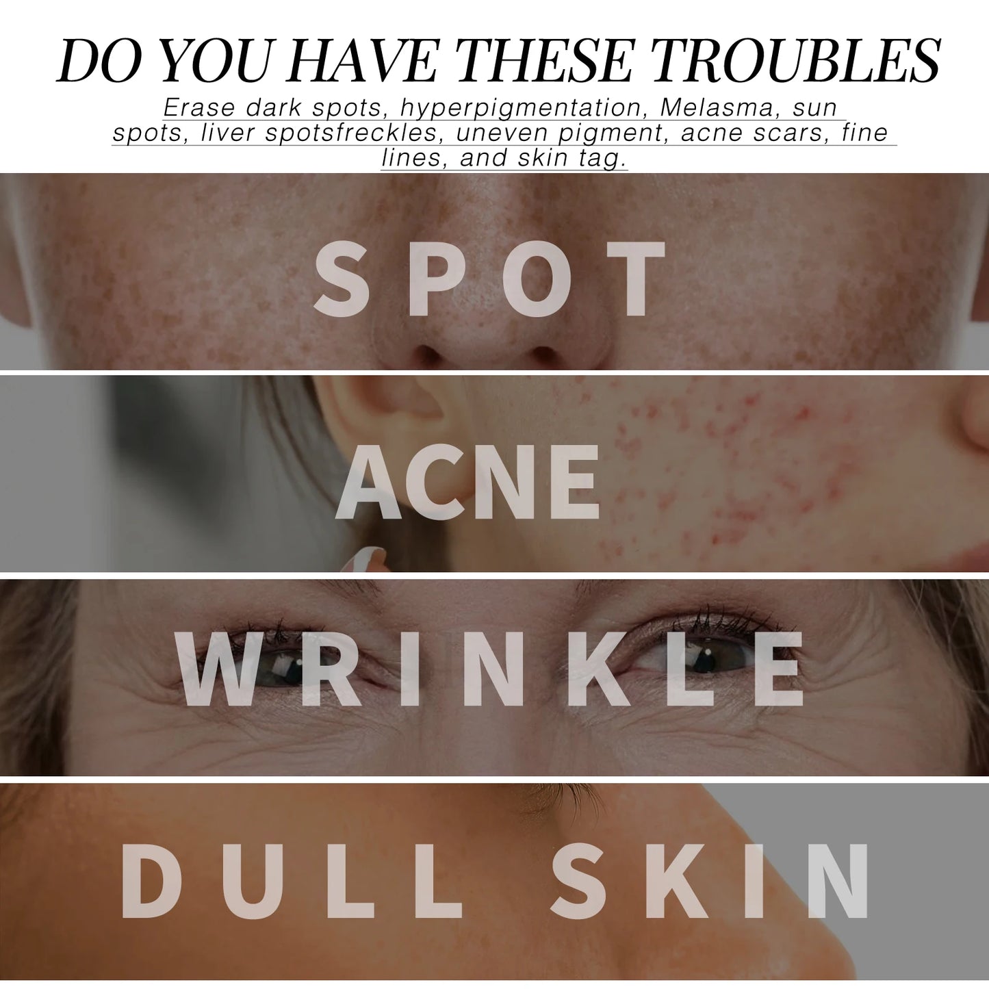 Retinol Face Serum Facial Dark Spot Remover Fade Acne Marks Moisturizer Smooth Skin Hydrating Beauty Health Skin Care Essence