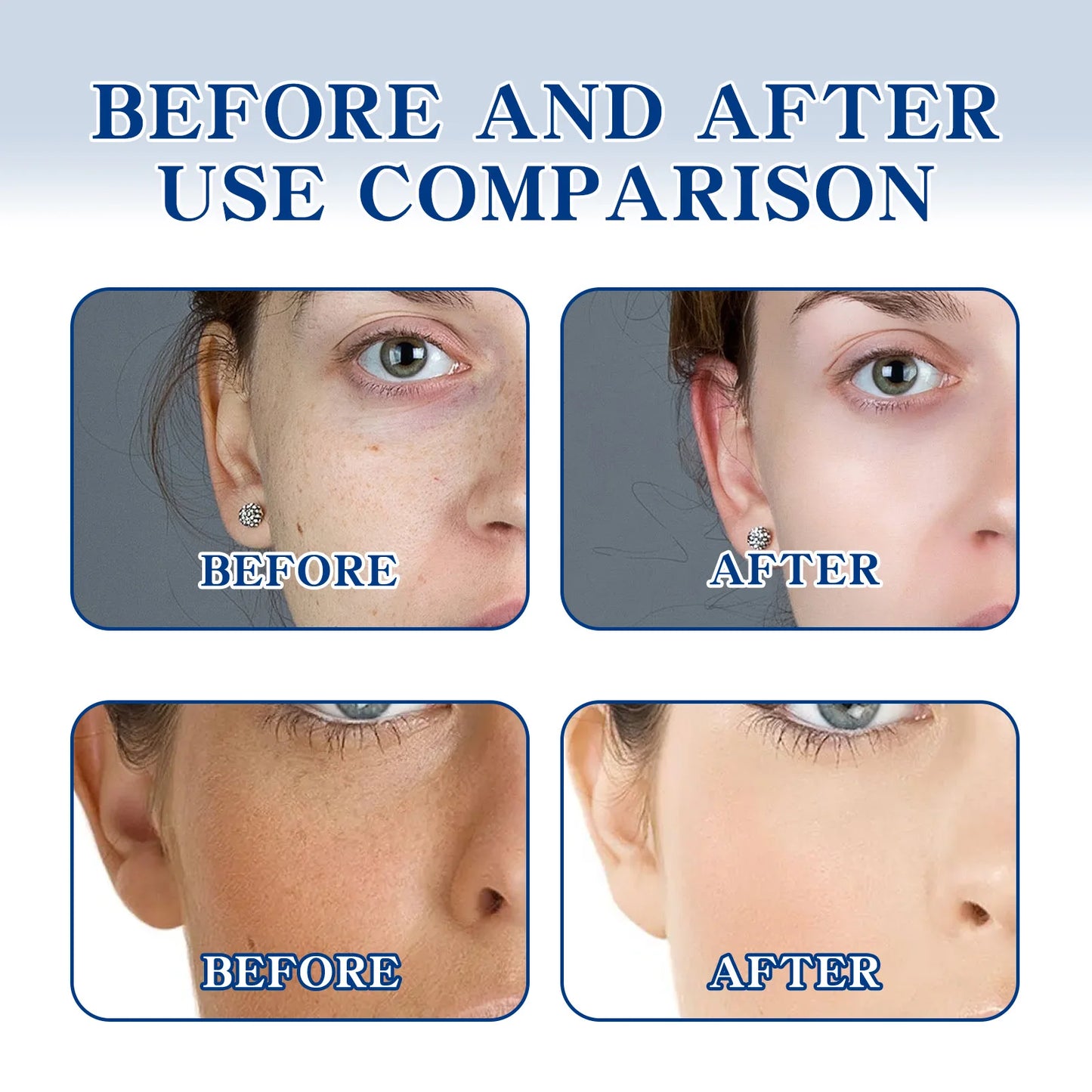 OUHOE Whitening Face Cream Moisturizes and Brightens Skin