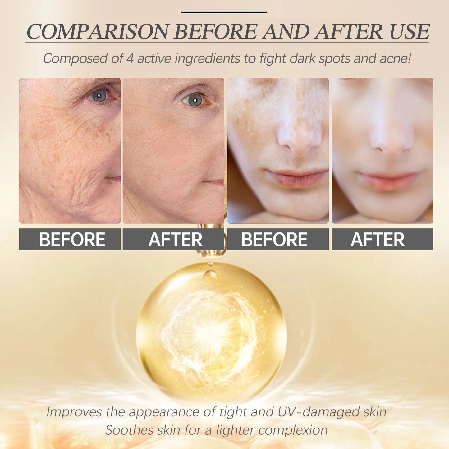 Retinol Face Serum Facial Dark Spot Remover Fade Acne Marks Moisturizer Smooth Skin Hydrating Beauty Health Skin Care Essence