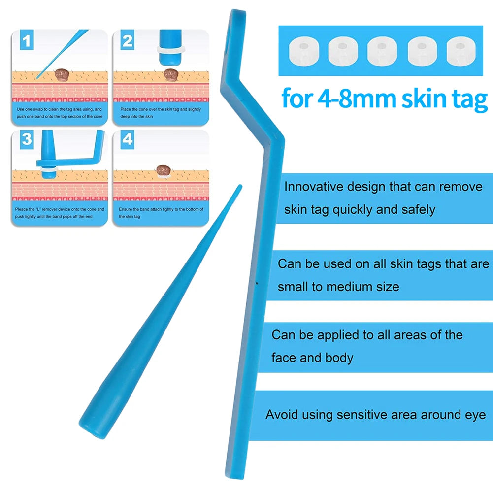 Skin Tag Remover Device for Large Mole Wart Removal