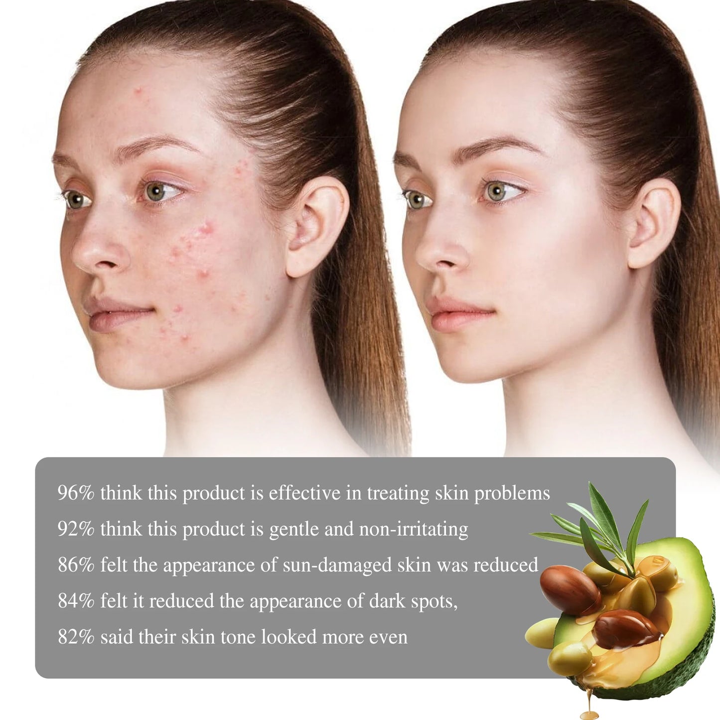 Retinol Face Serum Facial Dark Spot Remover Fade Acne Marks Moisturizer Smooth Skin Hydrating Beauty Health Skin Care Essence