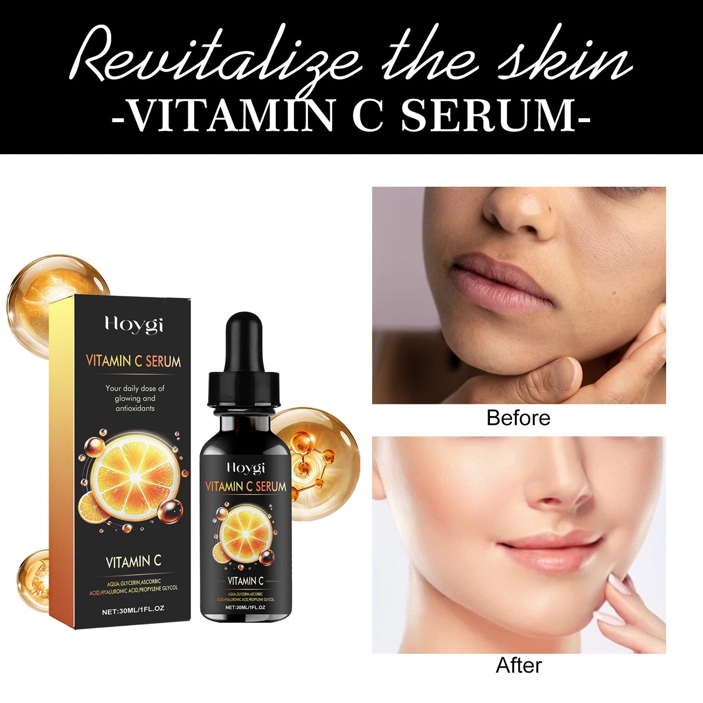 Hoygi 30ml Vitamin C Nourish Face Serum Reduce Fine Line Wrinkle Remove Dark Spots Improve Skin Elasticity Brighten Facial Serum