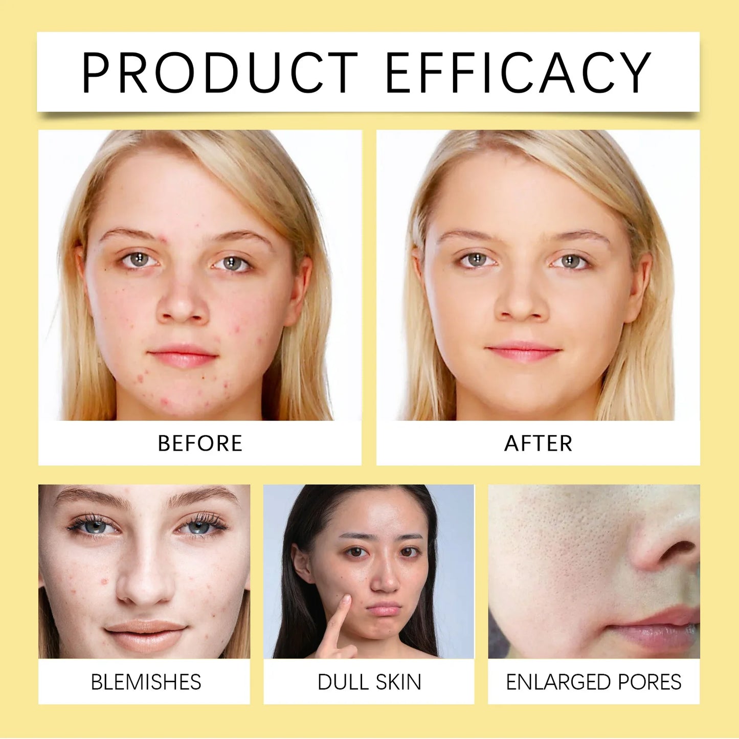 Niacinamide Cleanser Daily Cleanser Deep Cleansing Degrease