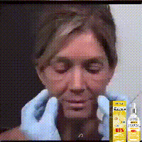 Retinol Anti-Wrinkle Essence Pure Hyaluronic Acid Serum
