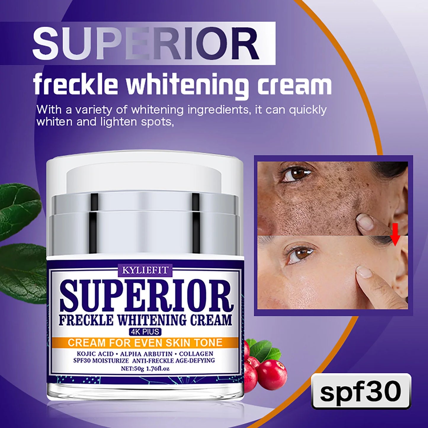 KYLIEFIT Dark Spot Remover for Face, Hyperpigmentation, Melasma, Freckle, Sun Spots Removal, Whitening Cream for Women and Men