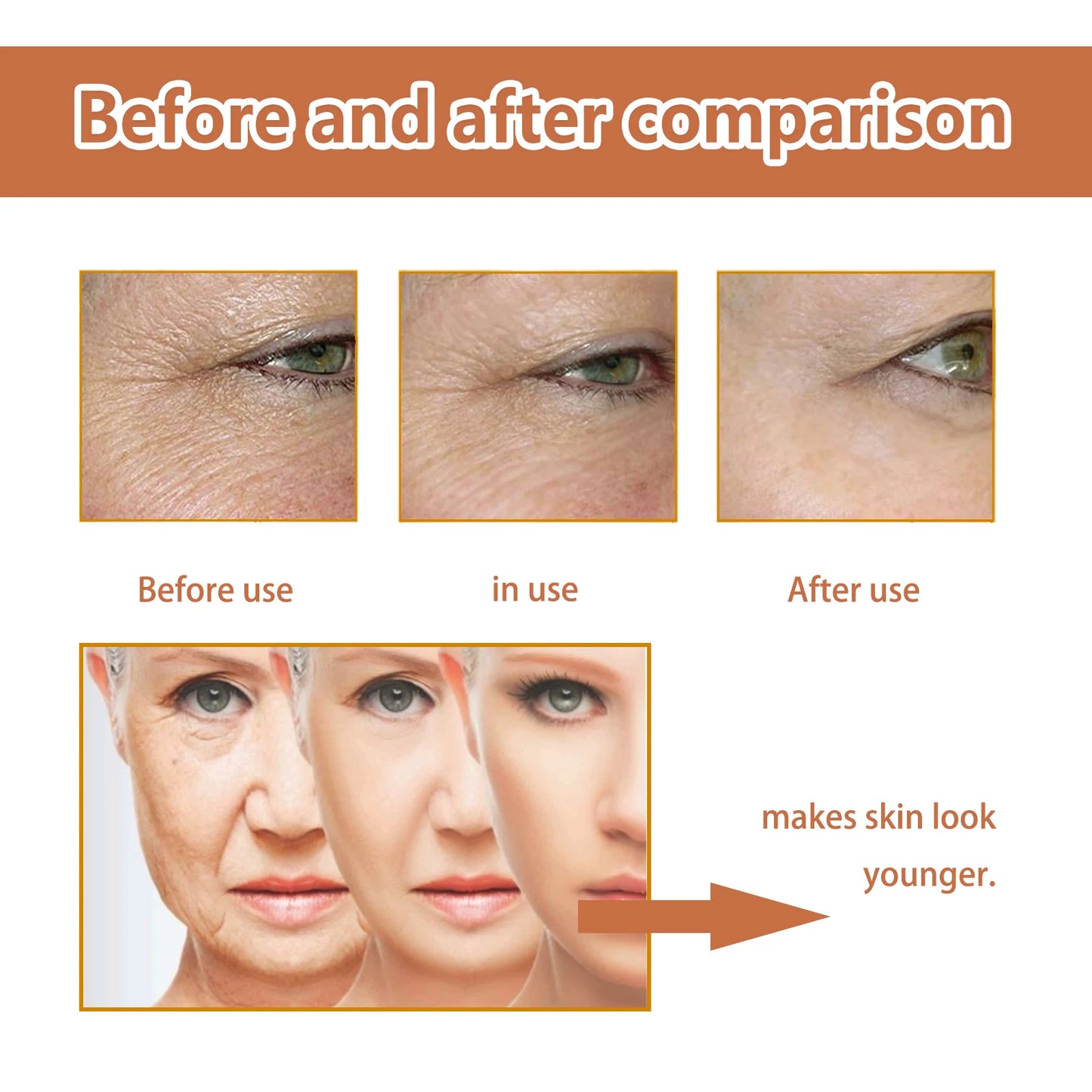 EELHOE Removes Large Pores and Tightens Face with Hydration